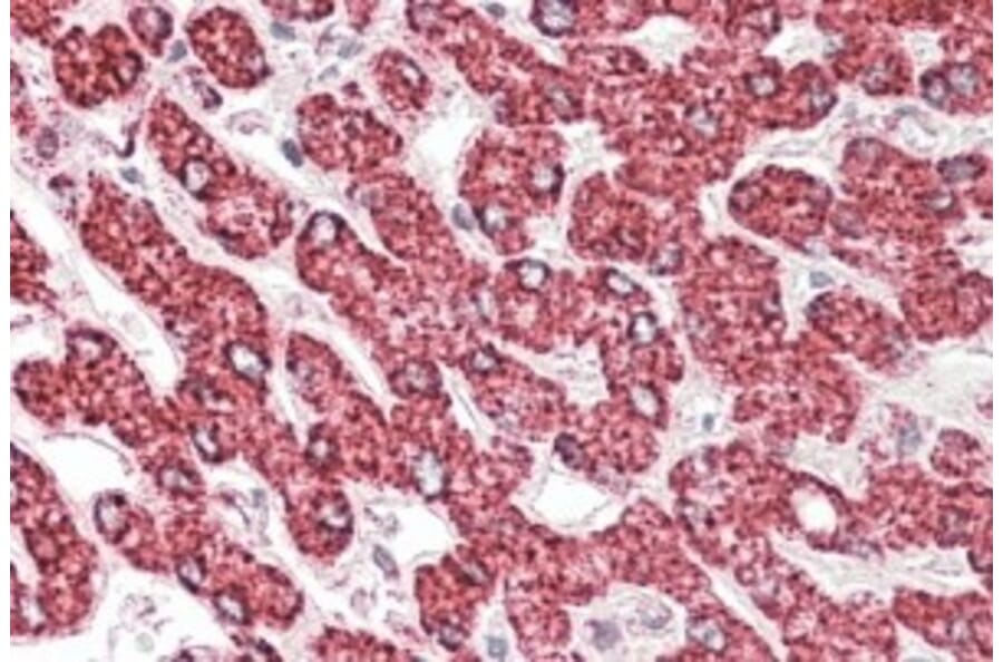 Immunohistochemistry - Anti-ETFB Antibody (A82910) - Antibodies.com