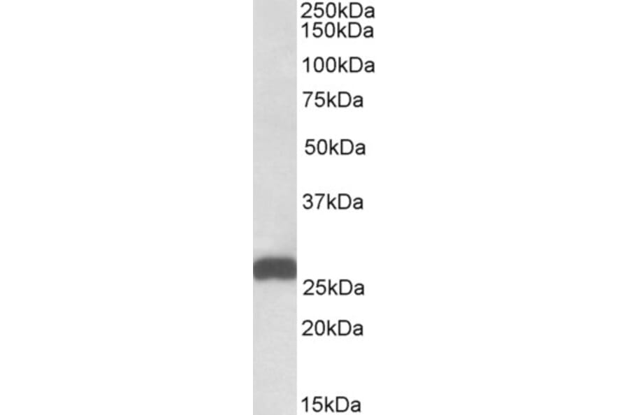 Western Blot - Anti-ETFB Antibody (A82911) - Antibodies.com