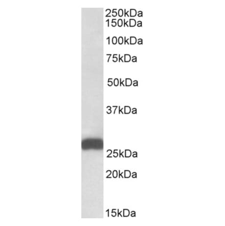 Western Blot - Anti-ETFB Antibody (A82911) - Antibodies.com