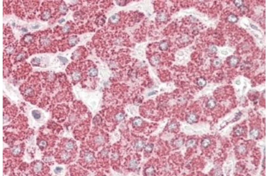 Immunohistochemistry - Anti-ETFB Antibody (A82911) - Antibodies.com
