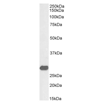 Western Blot - Anti-ETFB Antibody (A82912) - Antibodies.com