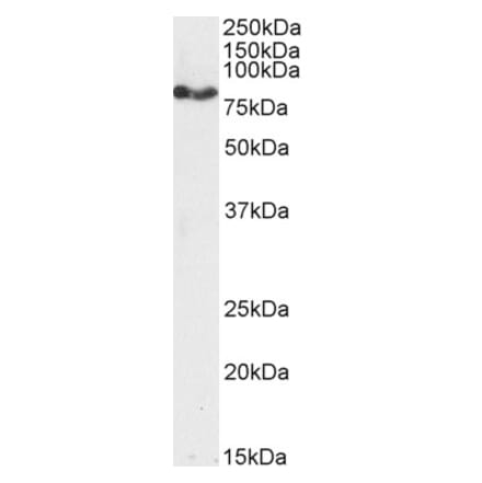 Western Blot - Anti-CPT1A Antibody (A82914) - Antibodies.com