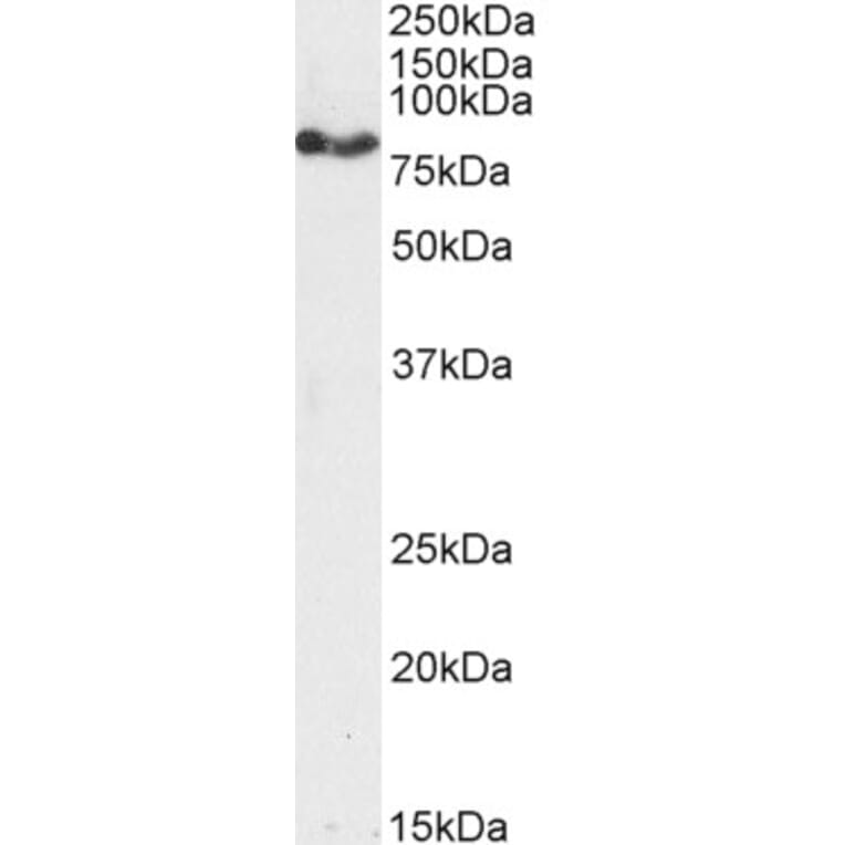 Western Blot - Anti-CPT1A Antibody (A82914) - Antibodies.com