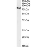 Western Blot - Anti-CPT1A Antibody (A82914) - Antibodies.com