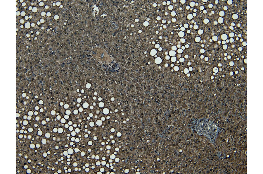 Immunohistochemistry - Anti-CPT1A Antibody (A82914) - Antibodies.com