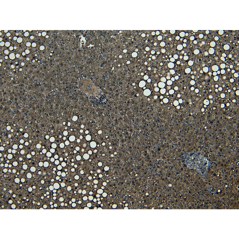 Immunohistochemistry - Anti-CPT1A Antibody (A82914) - Antibodies.com
