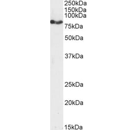 Western Blot - Anti-CPT1A Antibody (A82914)