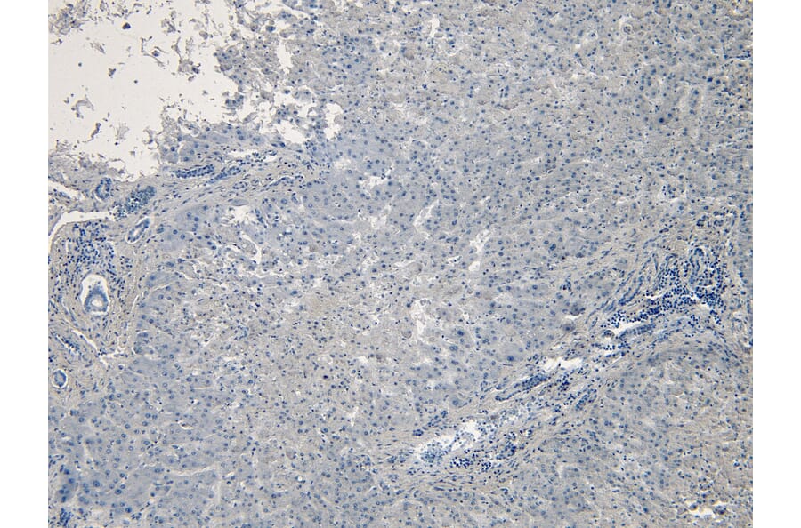 Immunohistochemistry - Anti-CPT1A Antibody (A82914) - Antibodies.com