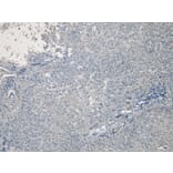 Immunohistochemistry - Anti-CPT1A Antibody (A82914) - Antibodies.com
