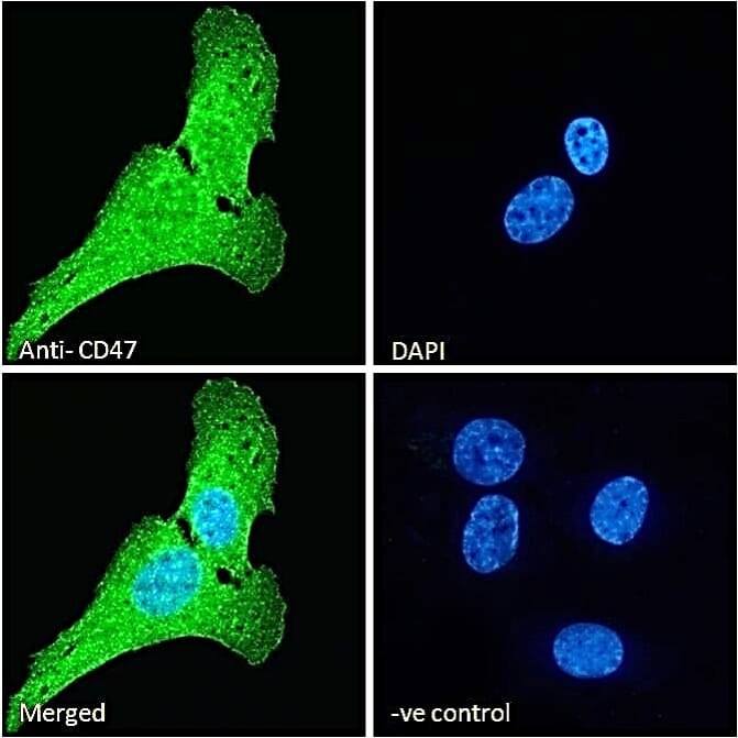 Anti-CD47 Antibody (A82915) | Antibodies.com