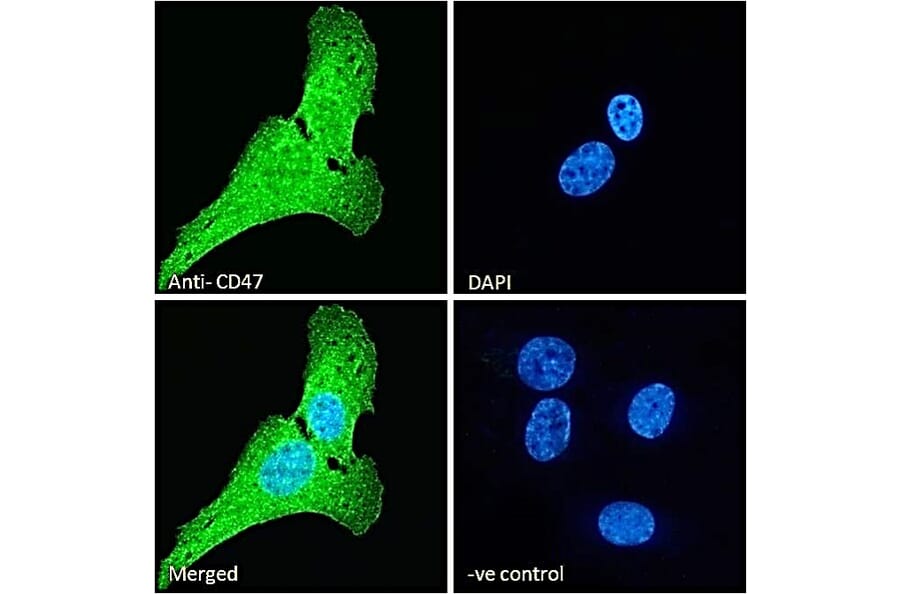 Immunofluorescence - Anti-CD47 Antibody (A82915) - Antibodies.com