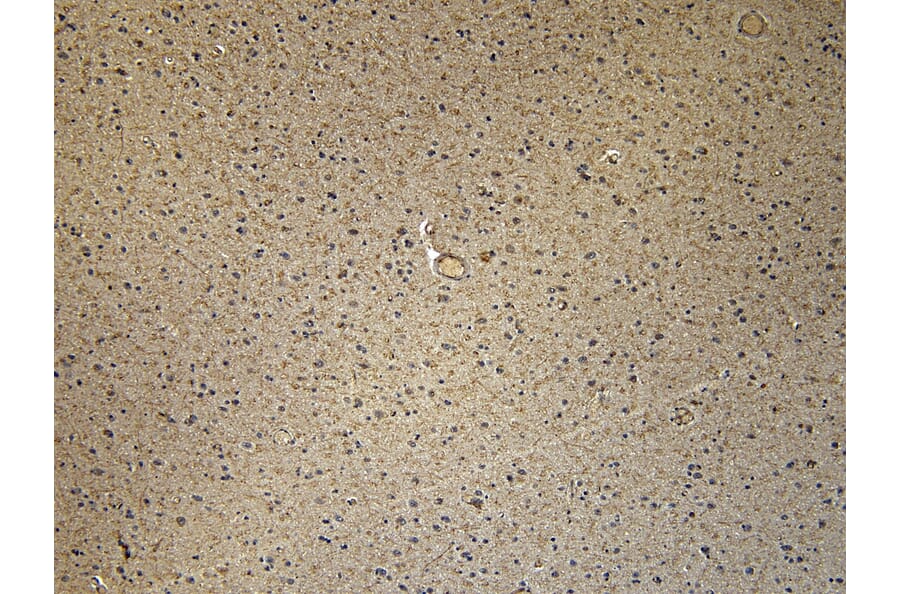 Immunohistochemistry - Anti-CD47 Antibody (A82915) - Antibodies.com