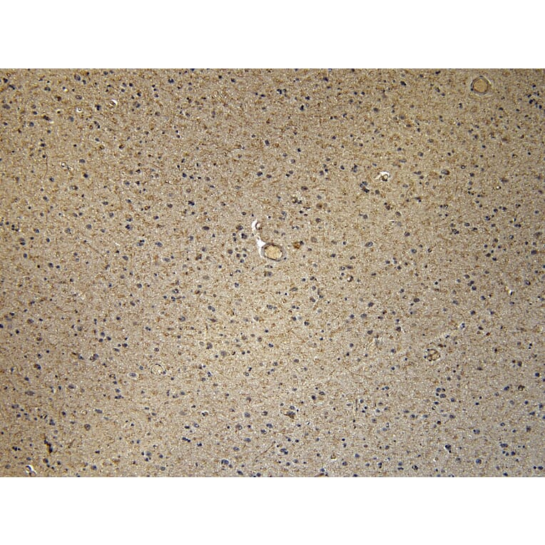 Immunohistochemistry - Anti-CD47 Antibody (A82915) - Antibodies.com