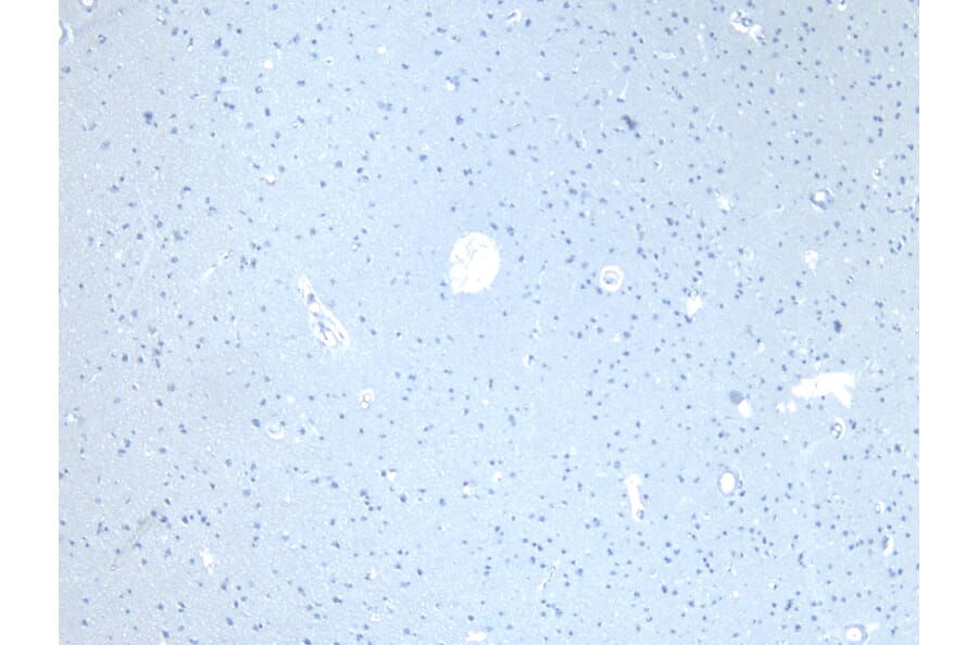 Immunohistochemistry - Anti-CD47 Antibody (A82915) - Antibodies.com