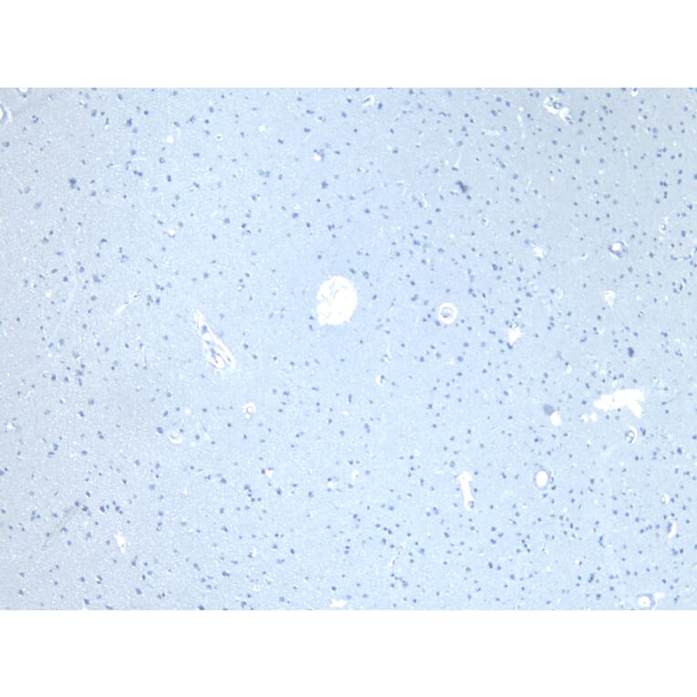 Immunohistochemistry - Anti-CD47 Antibody (A82915) - Antibodies.com