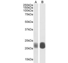 Western Blot - Anti-Caveolin-1 Antibody (A82916) - Antibodies.com