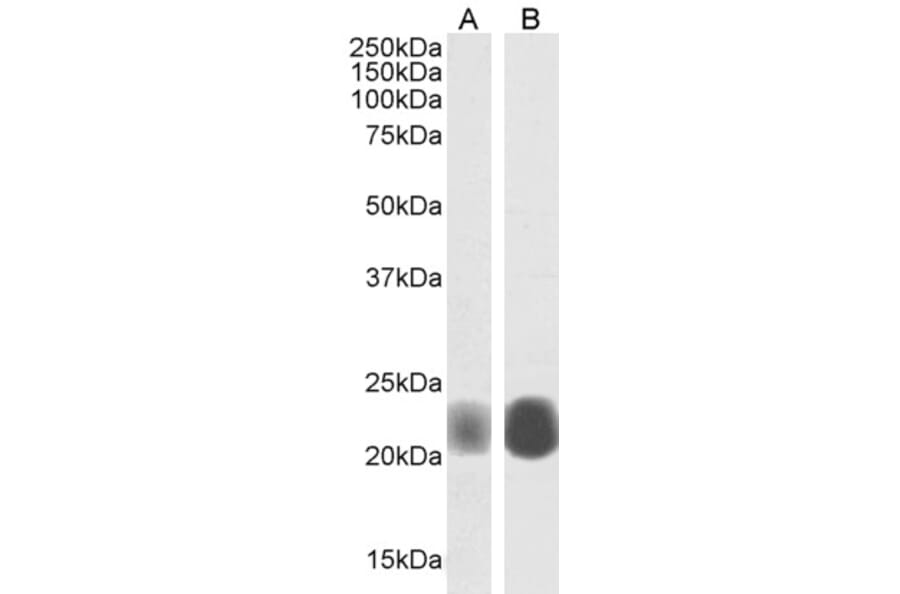 Western Blot - Anti-Caveolin-1 Antibody (A82916) - Antibodies.com