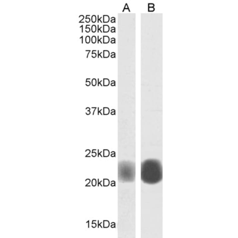 Western Blot - Anti-Caveolin-1 Antibody (A82916) - Antibodies.com