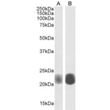 Western Blot - Anti-Caveolin-1 Antibody (A82916) - Antibodies.com