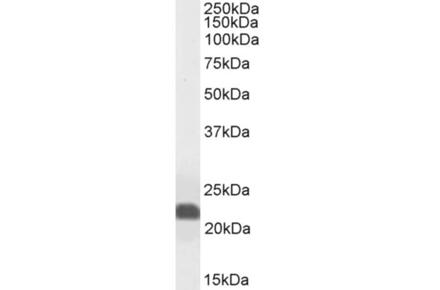 Western Blot - Anti-Caveolin-1 Antibody (A82916) - Antibodies.com