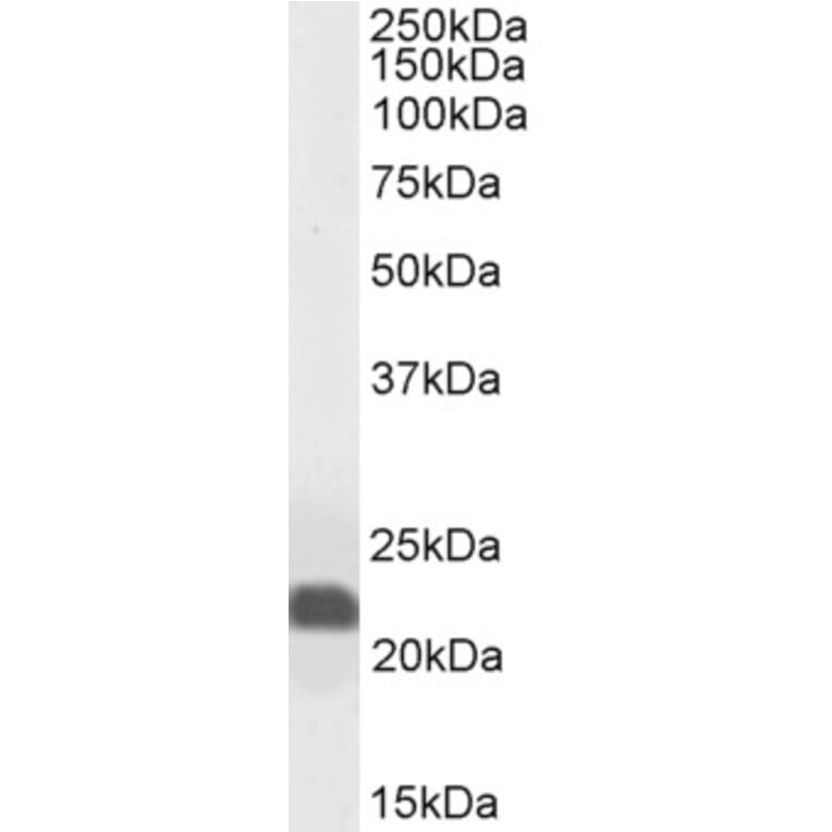 Western Blot - Anti-Caveolin-1 Antibody (A82916) - Antibodies.com