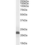 Western Blot - Anti-Caveolin-1 Antibody (A82916) - Antibodies.com