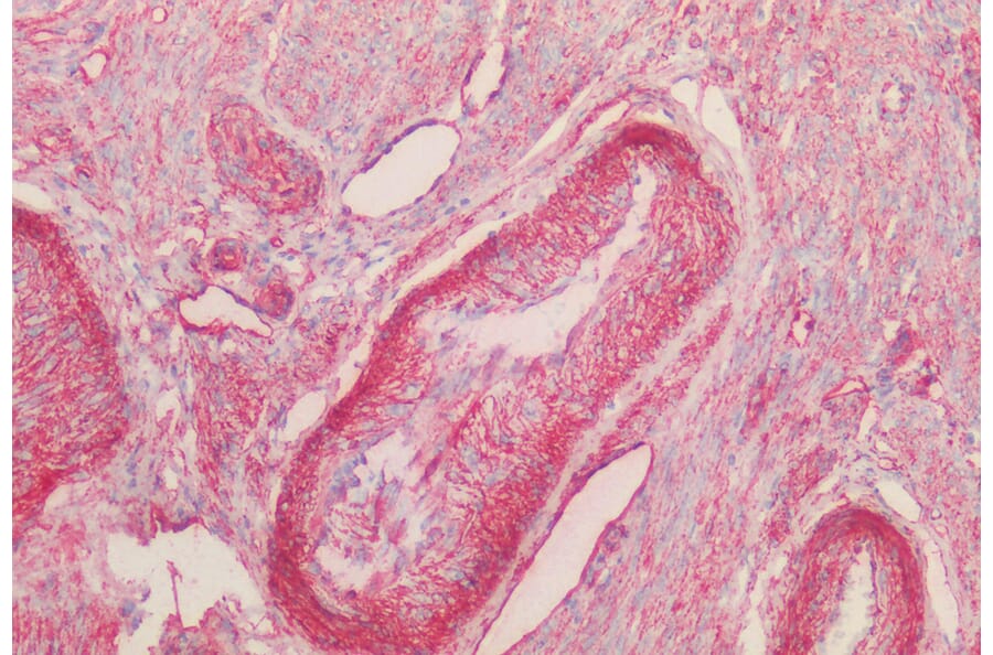 Immunohistochemistry - Anti-Caveolin-1 Antibody (A82916) - Antibodies.com