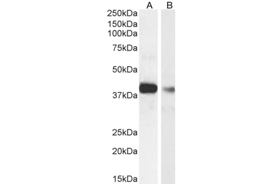 Western Blot - Anti-Actin Regulatory Protein CAPG/MCP Antibody (A82918) - Antibodies.com