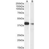 Western Blot - Anti-Actin Regulatory Protein CAPG/MCP Antibody (A82918) - Antibodies.com