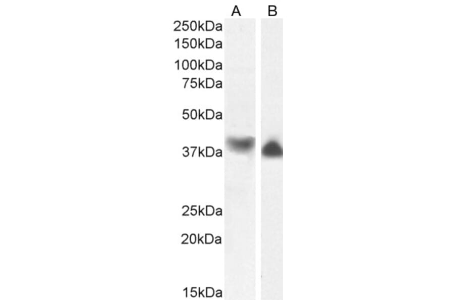 Western Blot - Anti-Actin Regulatory Protein CAPG/MCP Antibody (A82918) - Antibodies.com