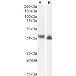 Western Blot - Anti-Actin Regulatory Protein CAPG/MCP Antibody (A82918) - Antibodies.com