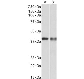 Western Blot - Anti-CAPG Antibody (A82918) - Antibodies.com