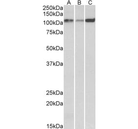 Western Blot - Anti-SERCA2 Antibody (A82919) - Antibodies.com