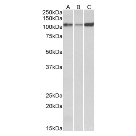 Western Blot - Anti-SERCA2 Antibody (A82919) - Antibodies.com