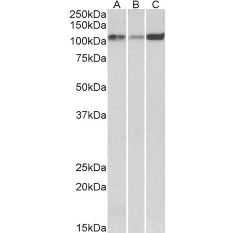 Western Blot - Anti-SERCA2 Antibody (A82919) - Antibodies.com