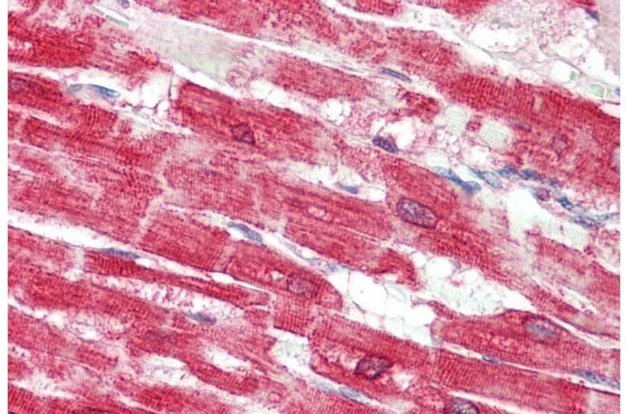 Immunohistochemistry - Anti-SERCA2 Antibody (A82919) - Antibodies.com