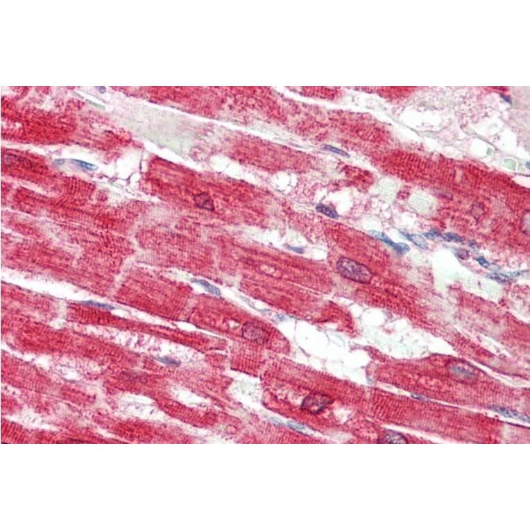 Immunohistochemistry - Anti-SERCA2 Antibody (A82919) - Antibodies.com