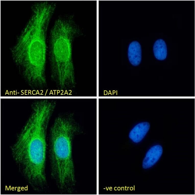 Immunofluorescence - Anti-SERCA2 Antibody (A82919) - Antibodies.com