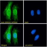 Immunofluorescence - Anti-SERCA2 Antibody (A82919) - Antibodies.com