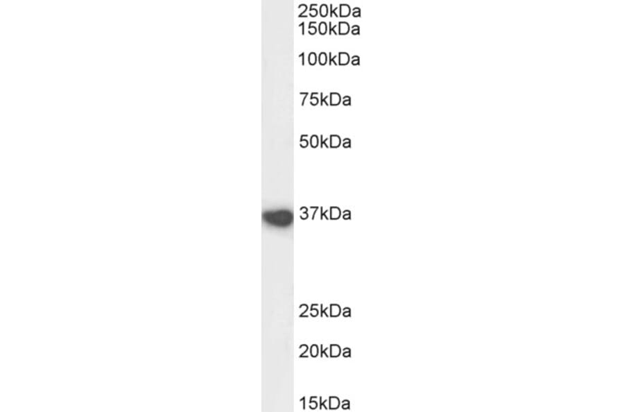 Western Blot - Anti-ATF-4 Antibody (A82921) - Antibodies.com