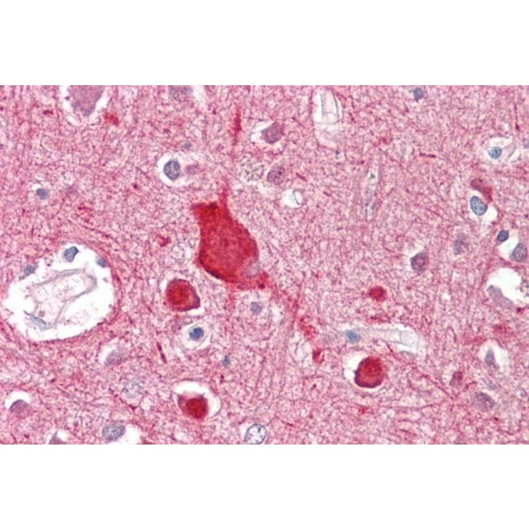 Immunohistochemistry - Anti-ABCA2 Antibody (A82924) - Antibodies.com