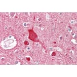 Immunohistochemistry - Anti-ABCA2 Antibody (A82924) - Antibodies.com