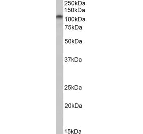 Western Blot - Anti-DLG4 Antibody (A82926) - Antibodies.com