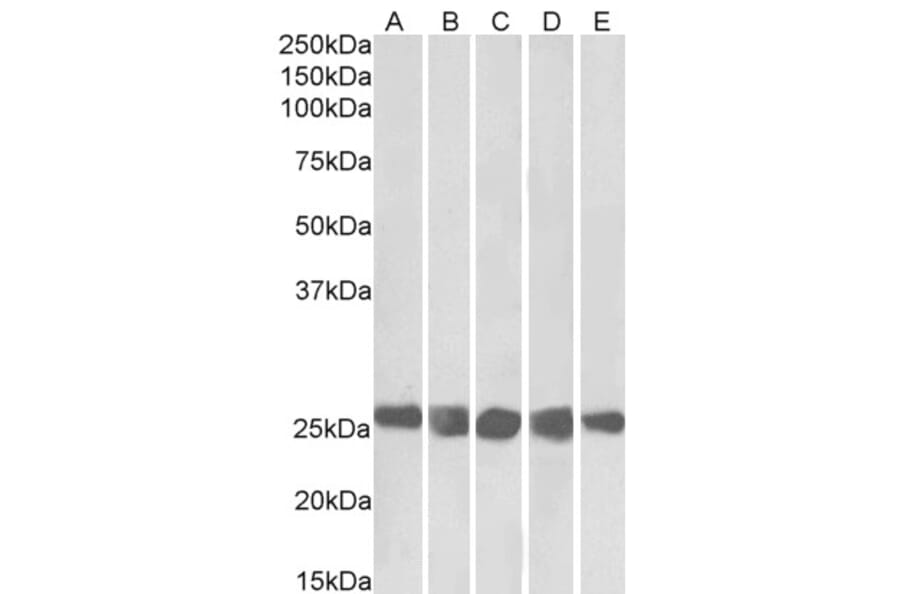 Western Blot - Anti-Casein Kinase 2 beta Antibody (A82927) - Antibodies.com
