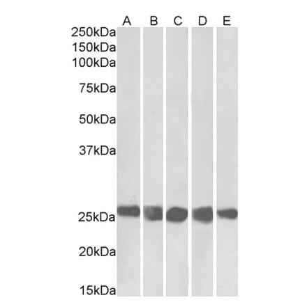 Western Blot - Anti-Casein Kinase 2 beta Antibody (A82927) - Antibodies.com
