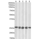 Western Blot - Anti-Casein Kinase 2 beta Antibody (A82927) - Antibodies.com