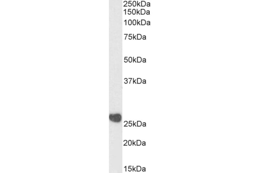 Western Blot - Anti-Casein Kinase 2 beta Antibody (A82927) - Antibodies.com
