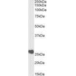 Western Blot - Anti-Casein Kinase 2 beta Antibody (A82927) - Antibodies.com