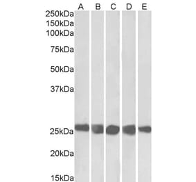 Western Blot - Anti-CSNK2B Antibody (A82927) - Antibodies.com