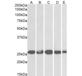 Western Blot - Anti-Casein Kinase 2 beta Antibody (A82928) - Antibodies.com